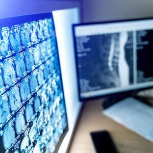 Radiology and Interventional Radiology USCE An image highlighting the Radiology and Interventional Radiology U.S. Clinical Experience (USCE) opportunities, showcasing a technologically advanced medical office with a CT/MRI/PET scan film and computer monitor.