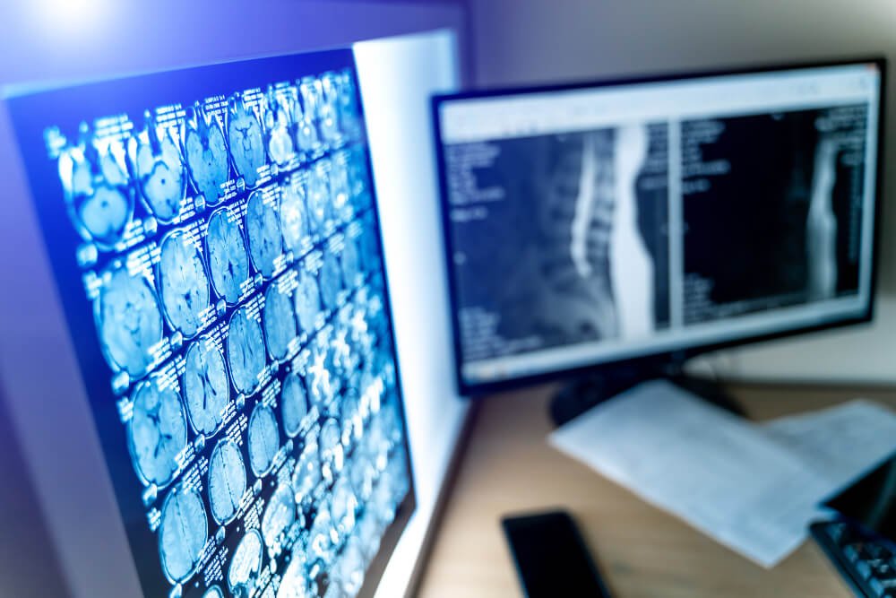 Radiology and Interventional Radiology USCE An image highlighting the Radiology and Interventional Radiology U.S. Clinical Experience (USCE) opportunities, showcasing a technologically advanced medical office with a CT/MRI/PET scan film and computer monitor.